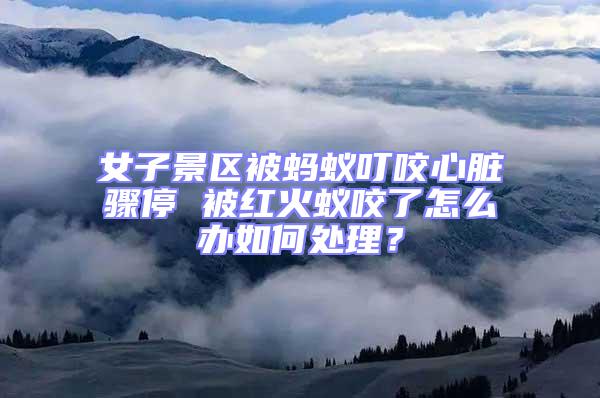 女子景區被螞蟻叮咬心臟驟停 被紅火蟻咬了怎么辦如何處理？